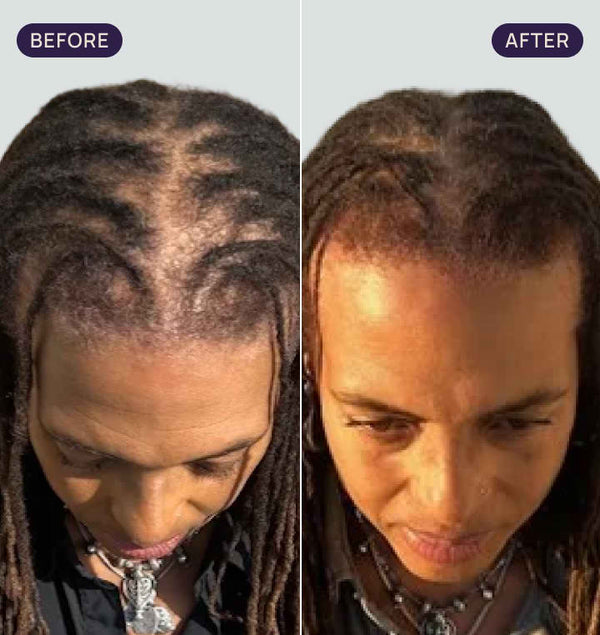 Before and after results