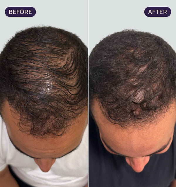 Before and after results