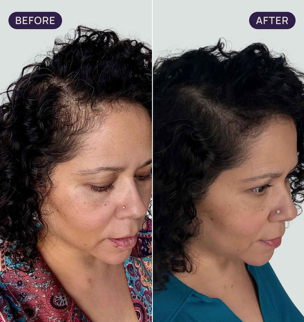 Before and after results