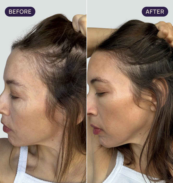 Before and after results