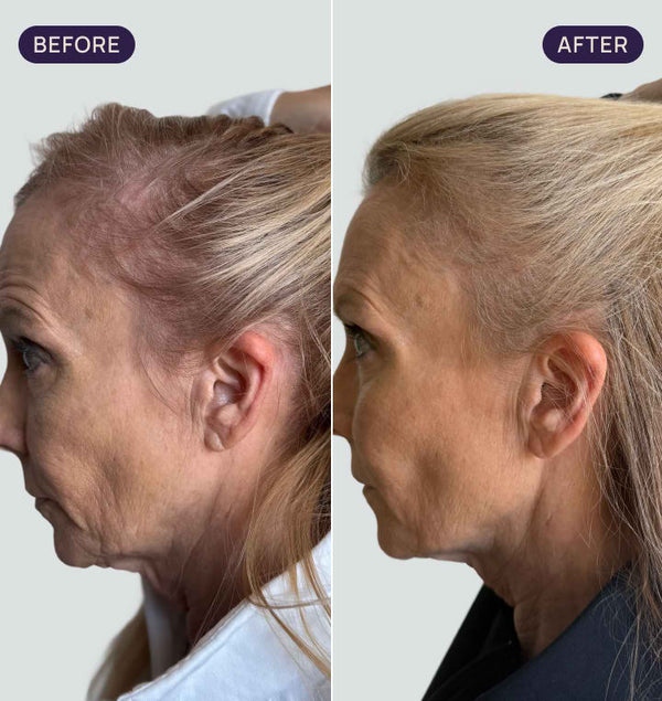 Before and after results