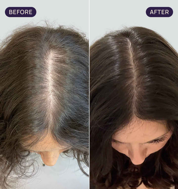 Before and after results