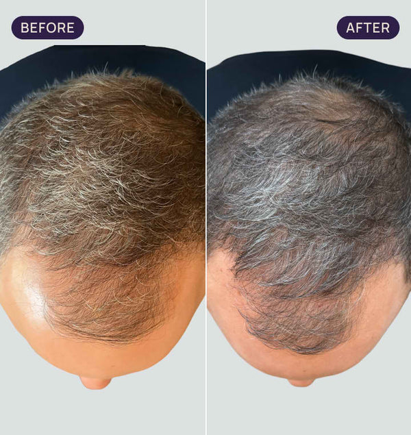 Before and after results