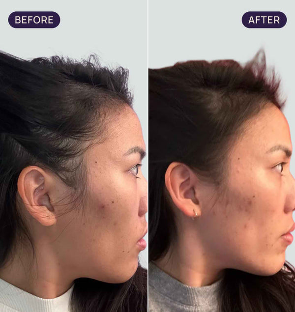 Before and after results