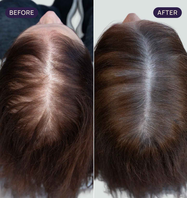 Before and after results