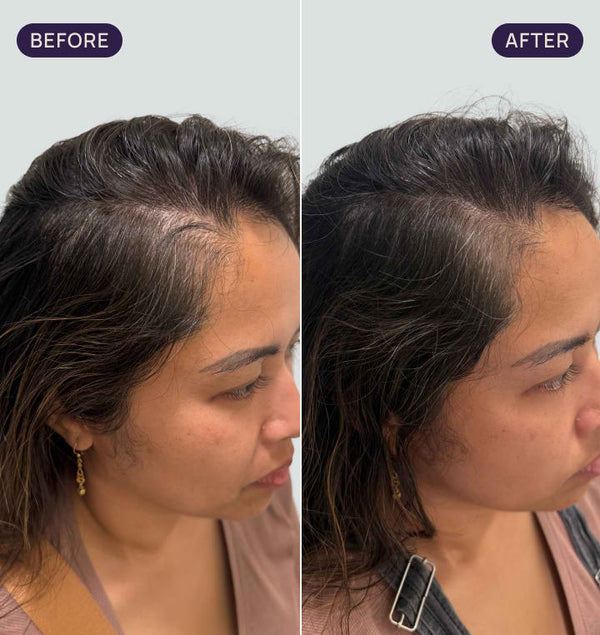 Before and after results