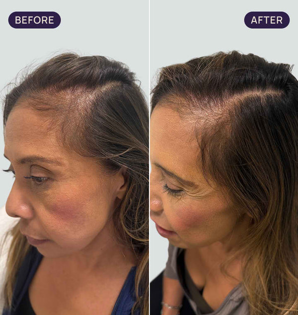 Before and after results
