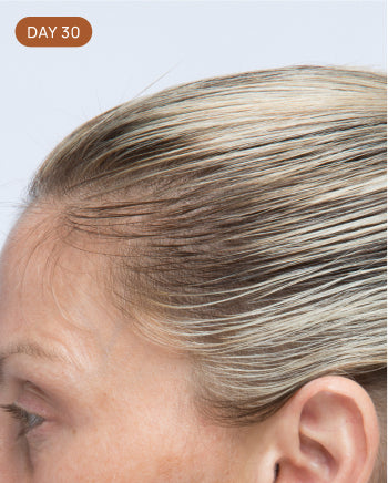 Results after 30 days
