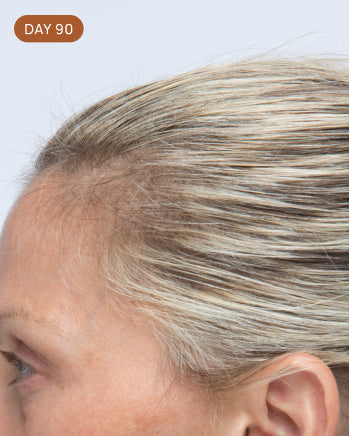 Results after 90 days